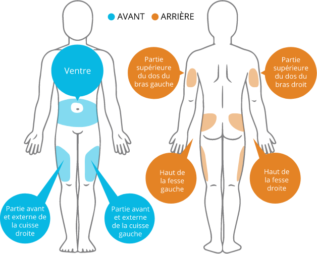 Human body with injection sites marked Human body with injection sites marked