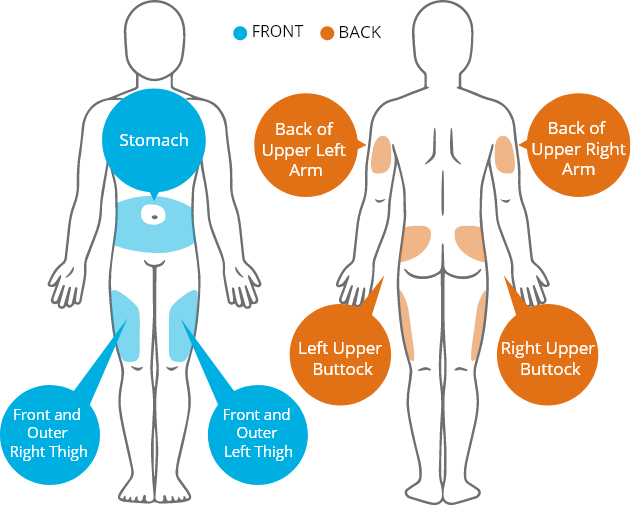 Human body with injection sites marked Human body with injection sites marked